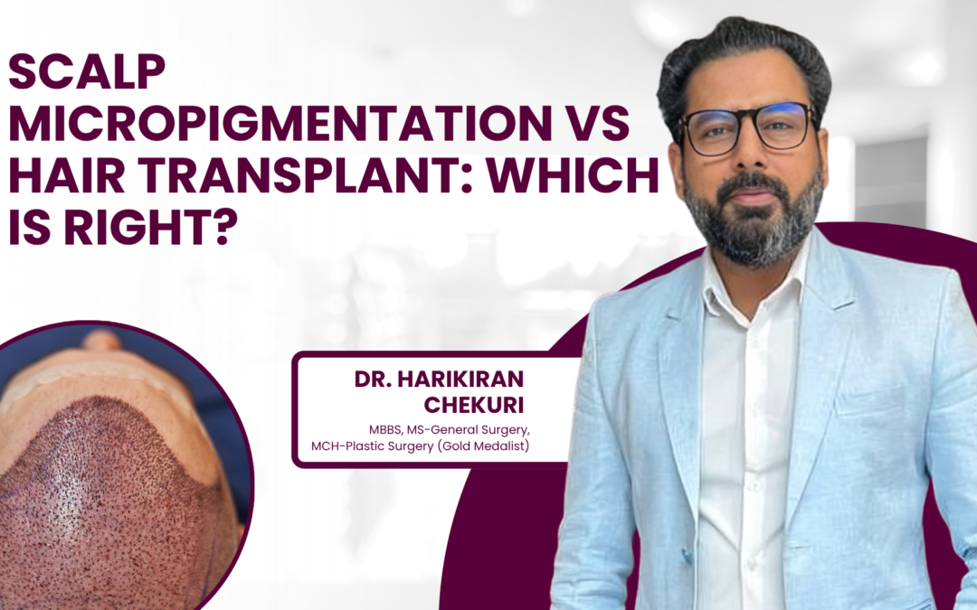 Scalp Micropigmentation vs Hair Transplant: Which Is Right for Me?