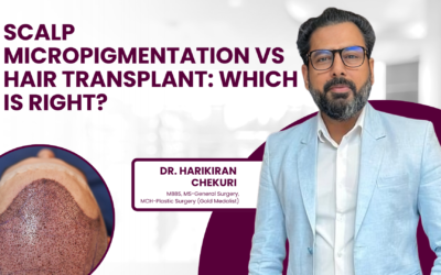 Scalp Micropigmentation vs Hair Transplant: Which Is Right for Me?