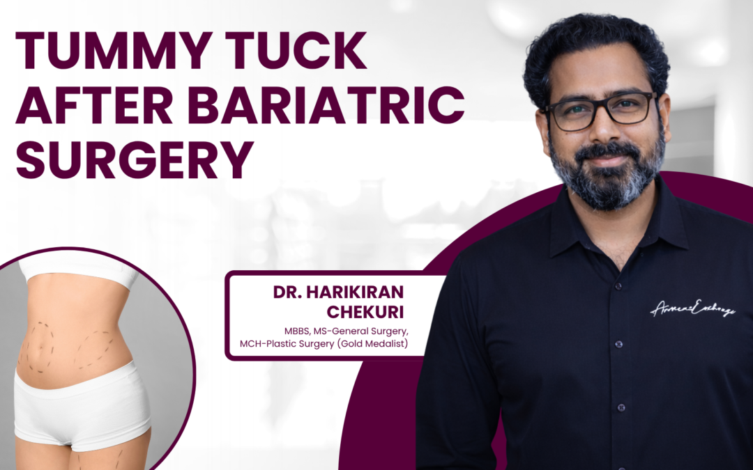 How Soon After Bariatric Surgery Can You Get a Tummy Tuck?
