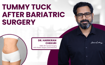 How Soon After Bariatric Surgery Can You Get a Tummy Tuck?
