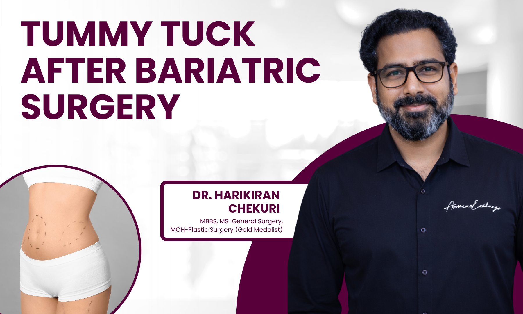 Tummy Tuck After Bariatric Surgery
