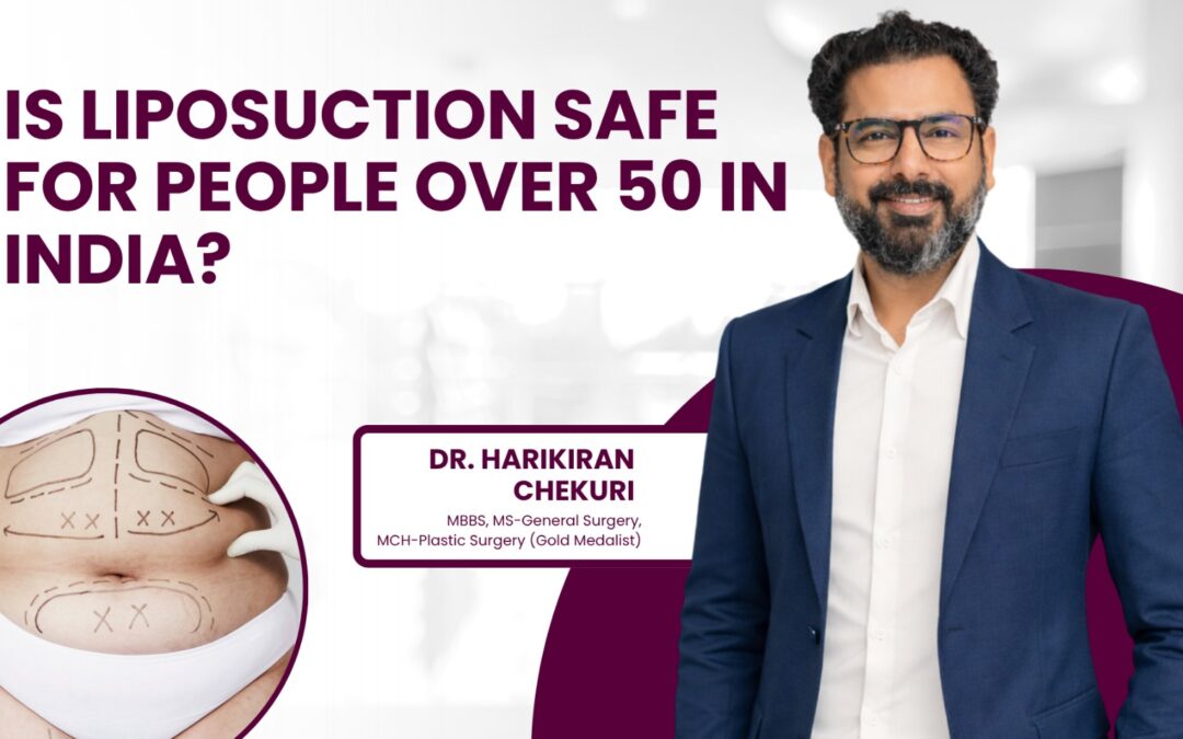 Is Liposuction Safe for People Over 50 in India?