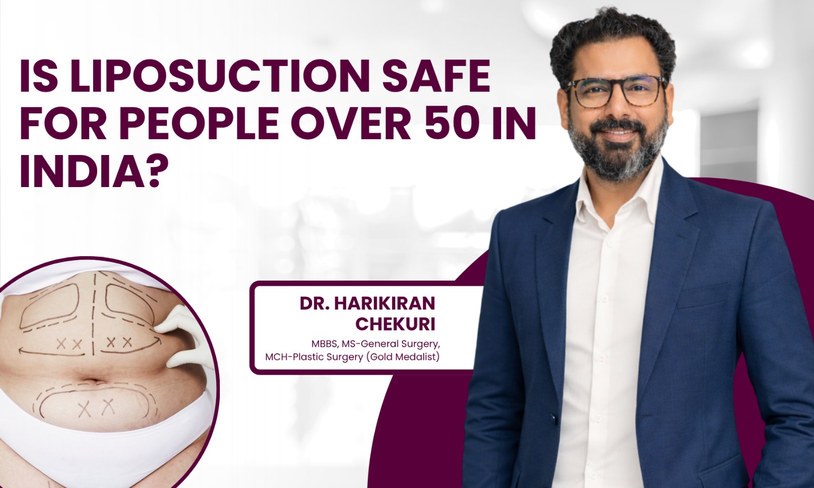 Is Liposuction Safe for People Over 50 in India – Dr. Harikiran Chekuri