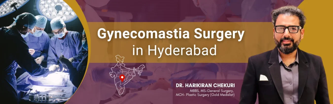 Banner advertising Gynecomastia Surgery in Hyderabad with a surgical team at left and a man in a suit on the right