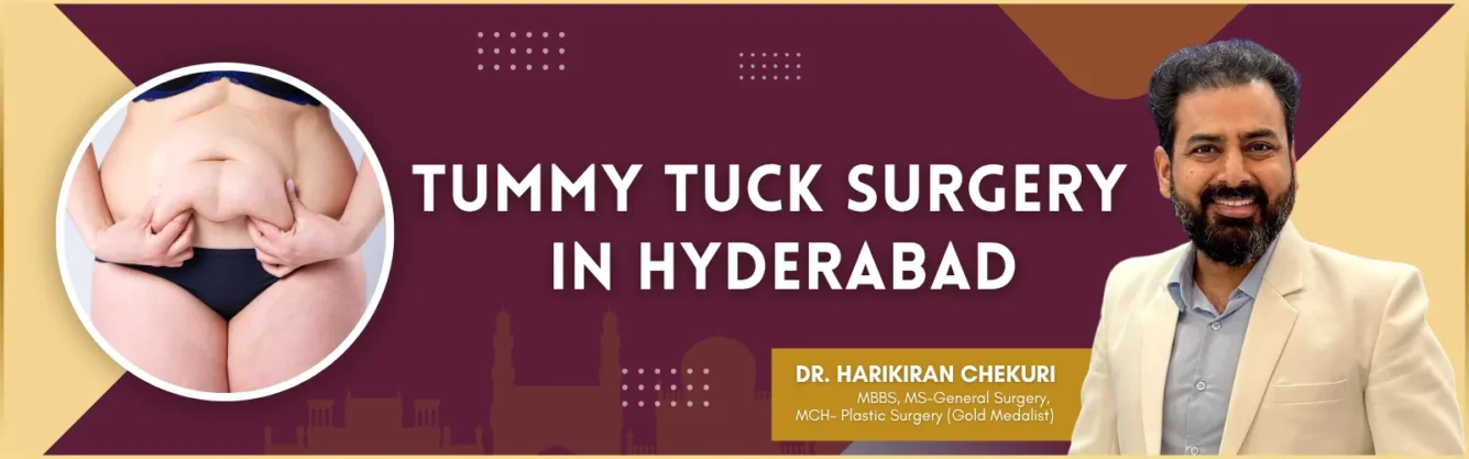 Banner advertising tummy tuck surgery in Hyderabad with Dr. Harikiran Chekuri on the right and a circular image of abdominal fat on the left.