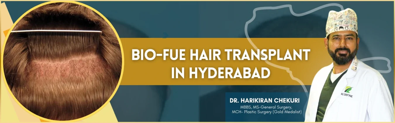 Bio-FUE Hair Transplant in Hyderabad