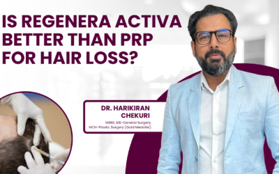 Is Regenera Activa Better Than PRP for Hair Loss?