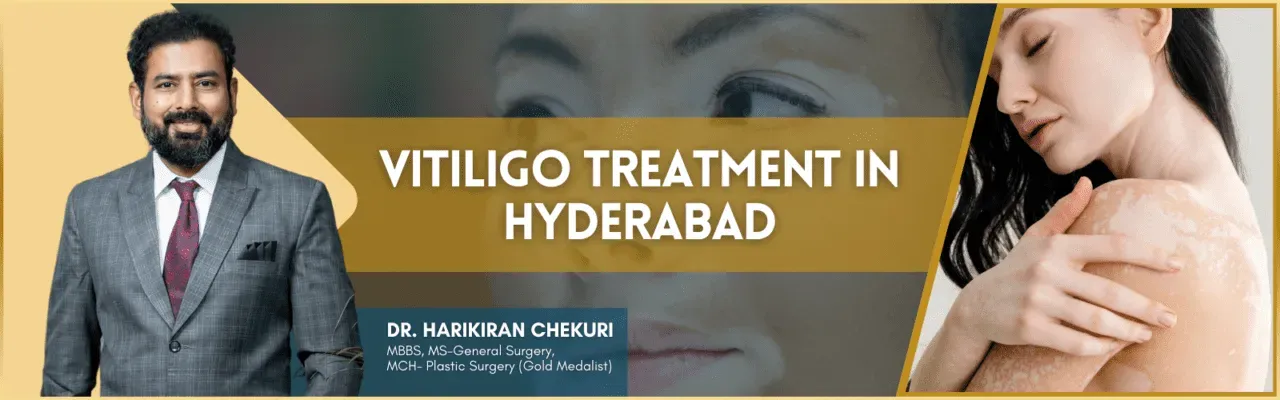 Banner with a man in a suit left, bold 'Vitiligo Treatment in Hyderabad' center, and a woman with vitiligo on the right.