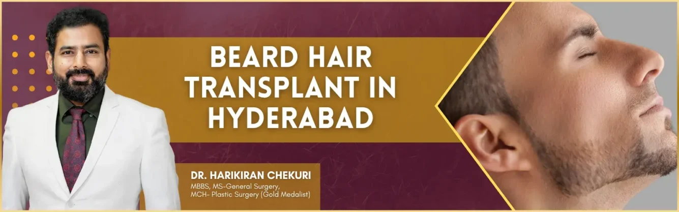 Beard Hair Transplant In Hyderabad