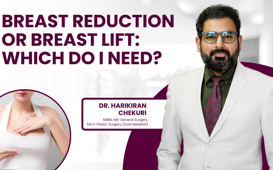 Breast Reduction or Breast Lift: Which One Do I Need?