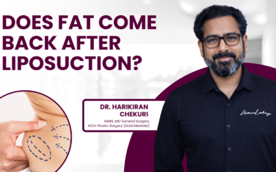 Does Fat Come Back After Liposuction?