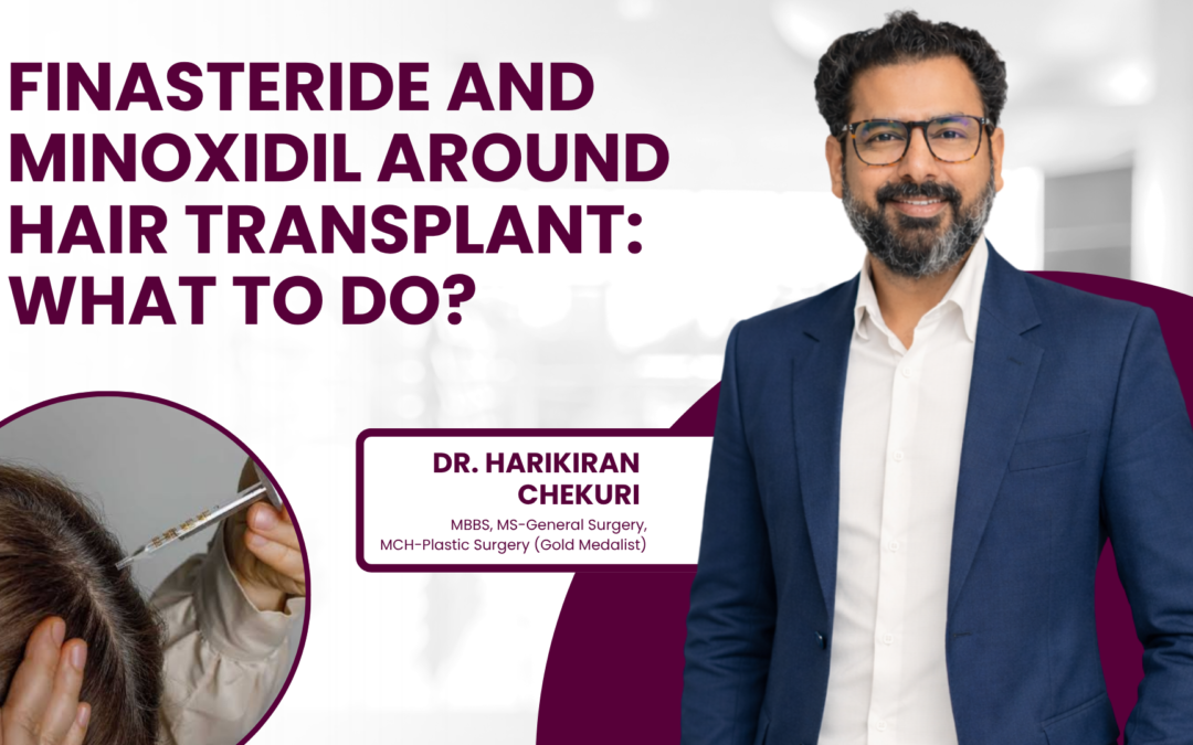 Finasteride and Minoxidil Around Hair Transplant: What to Do?