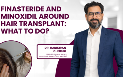 Finasteride and Minoxidil Around Hair Transplant: What to Do?