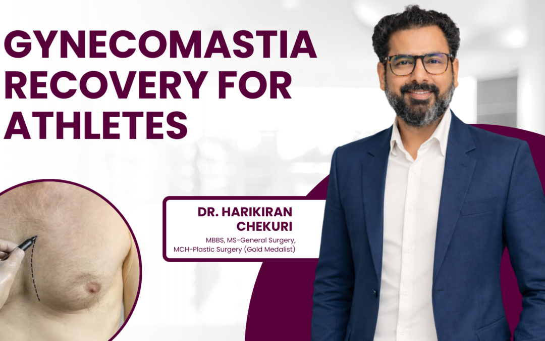 Recovery After Gynecomastia Surgery for Athletes and Gym-Goers
