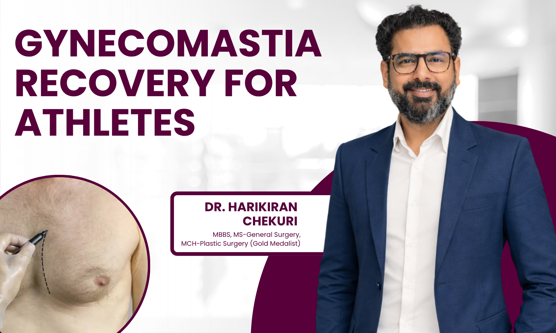 Gynecomastia Recovery for Athletes