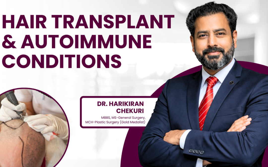 Can Hair Transplant Fail in Patients With Autoimmune Conditions?