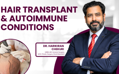 Can Hair Transplant Fail in Patients With Autoimmune Conditions?
