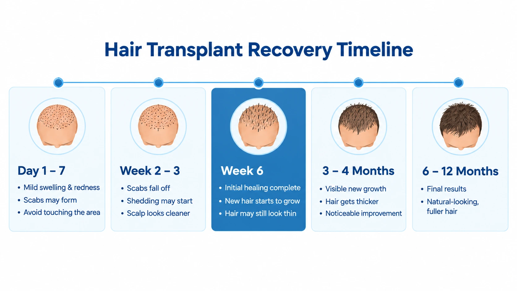 Hair Transplant Recovery Timeline showing 5 stages: Day 1–7, Week 2–3, Week 6 (initial healing complete; new hair grows), 3–4 Months, 6–12 Months with illustrated heads.