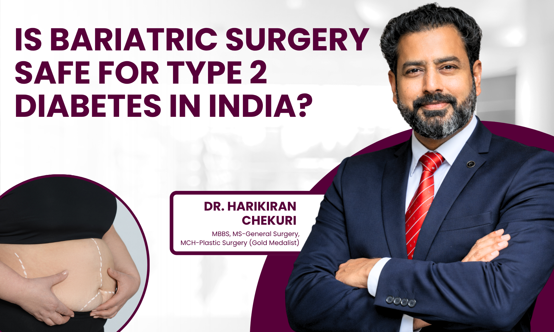 Is Bariatric Surgery Safe for Type 2 Diabetes in India