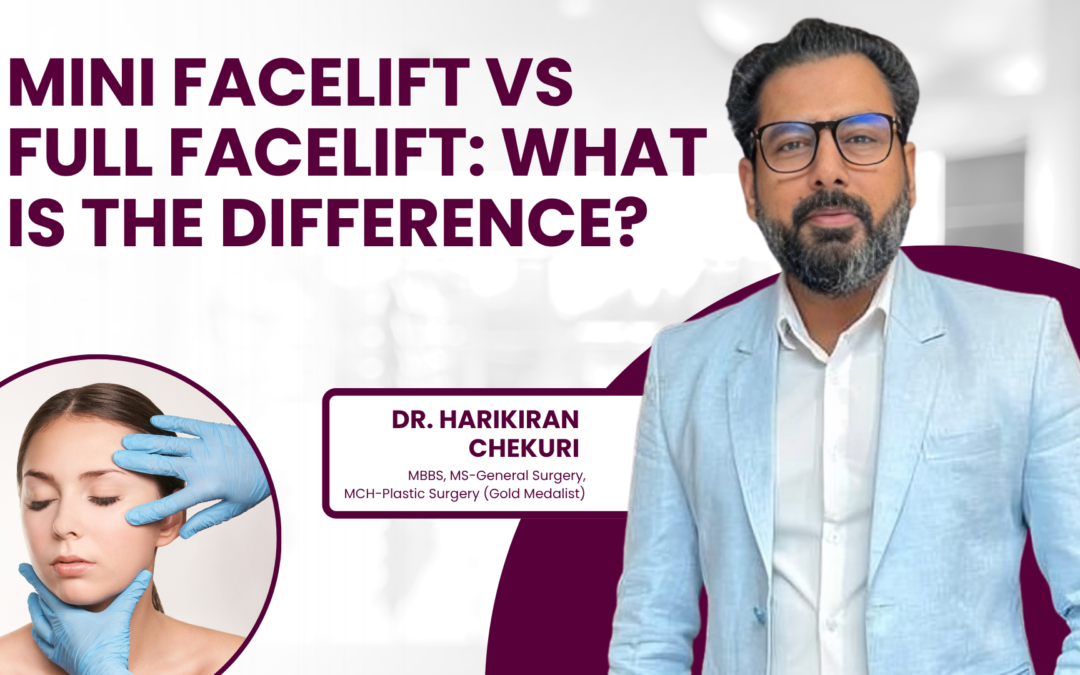 Difference Between Mini Facelift and Full Facelift?