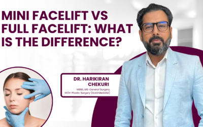 Difference Between Mini Facelift and Full Facelift?